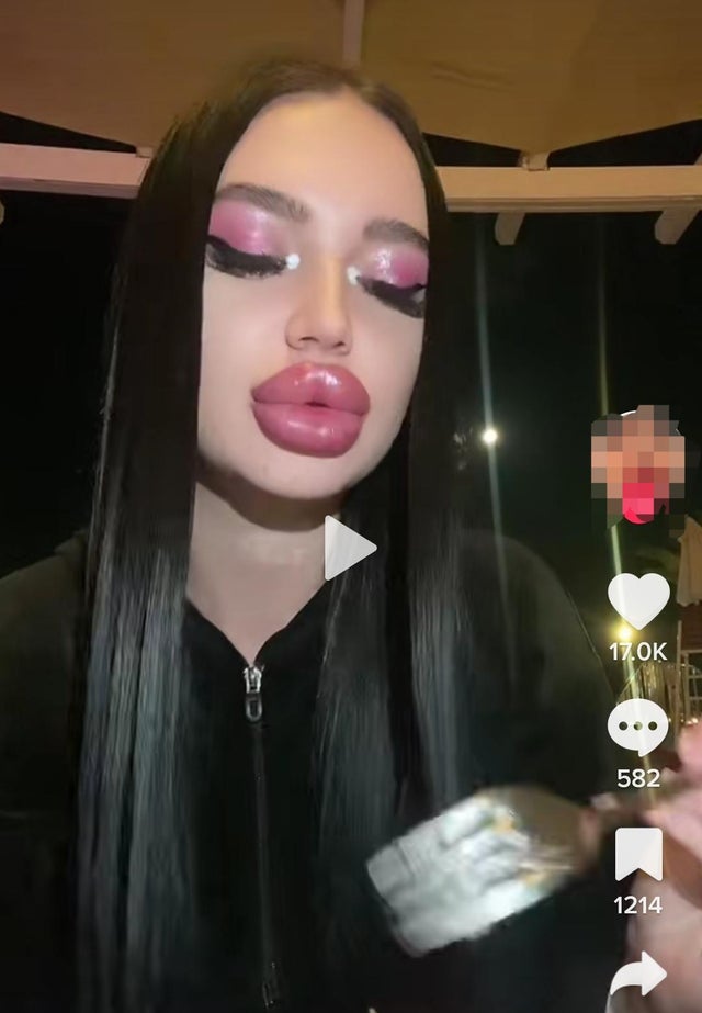 r/Botchedsurgeries - From tiktok
